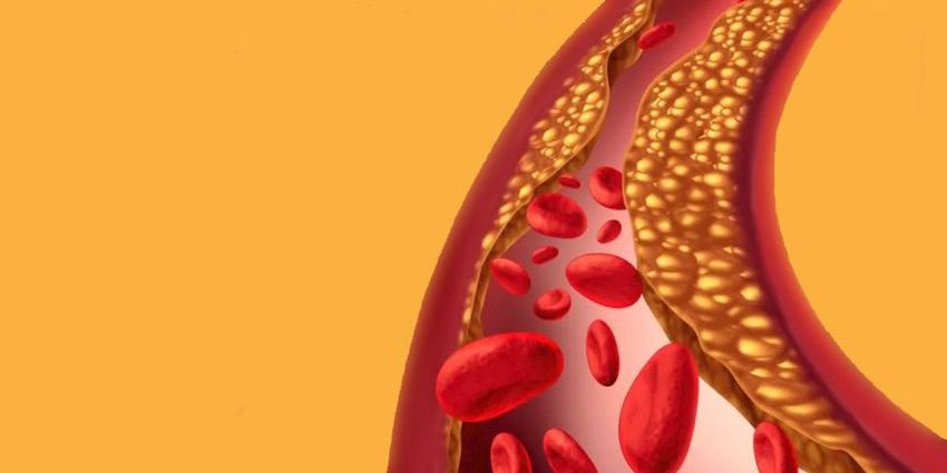 کلسترول چیست | درمان کلسترول خون بالا با تغذیه مناسب کلسترول چیست | درمان کلسترول خون بالا با تغذیه مناسب