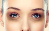 سیاهی دور چشم | علل ایجاد، جلوگیری و درمان