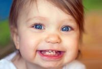 پوسیدگی دندان برخی نوزادان
