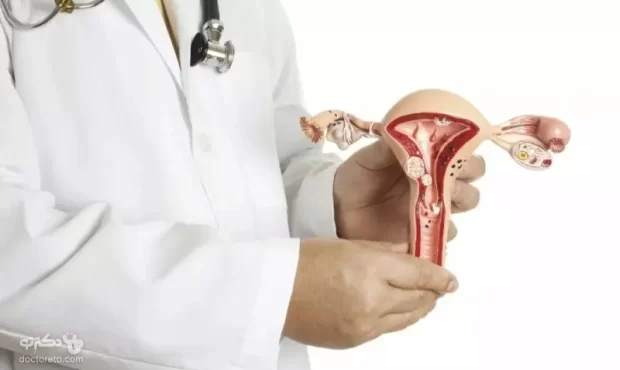 آیا درمان کیست تخمدان با رژیم غذایی ممکن است؟