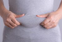 ۸درمان خانگی آب زیر پوست| دفع سریع و بی خطر آب اضافی بدن