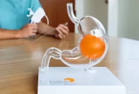 عمل بالن معده یا گاستریک بالون | لاغری با بالون معده