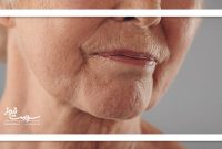 پیری زودرس را با علائم در این ۷ نقطه بدن بفهمید