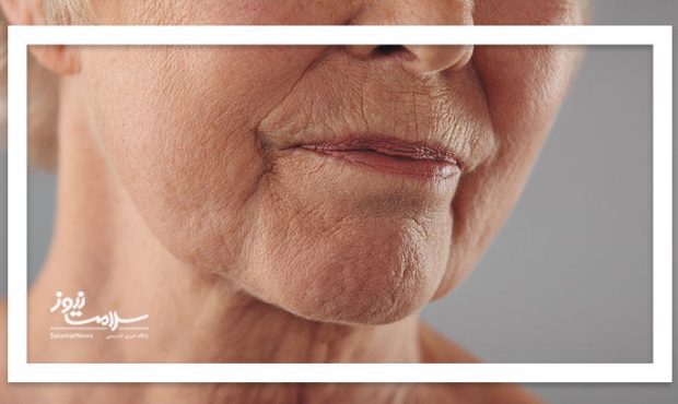 پیری زودرس را با علائم در این ۷ نقطه بدن بفهمید