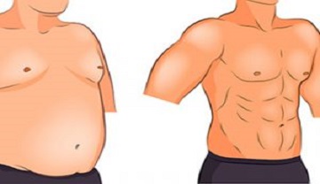 بهترین روش های درمان چربی سینه بهترین روش های درمان چربی سینه