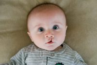 جراحی بینی لب شکری | رینوپلاستی بیماران شکاف لب و کام