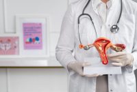 روش های درمان خانگی تنبلی تخمدان